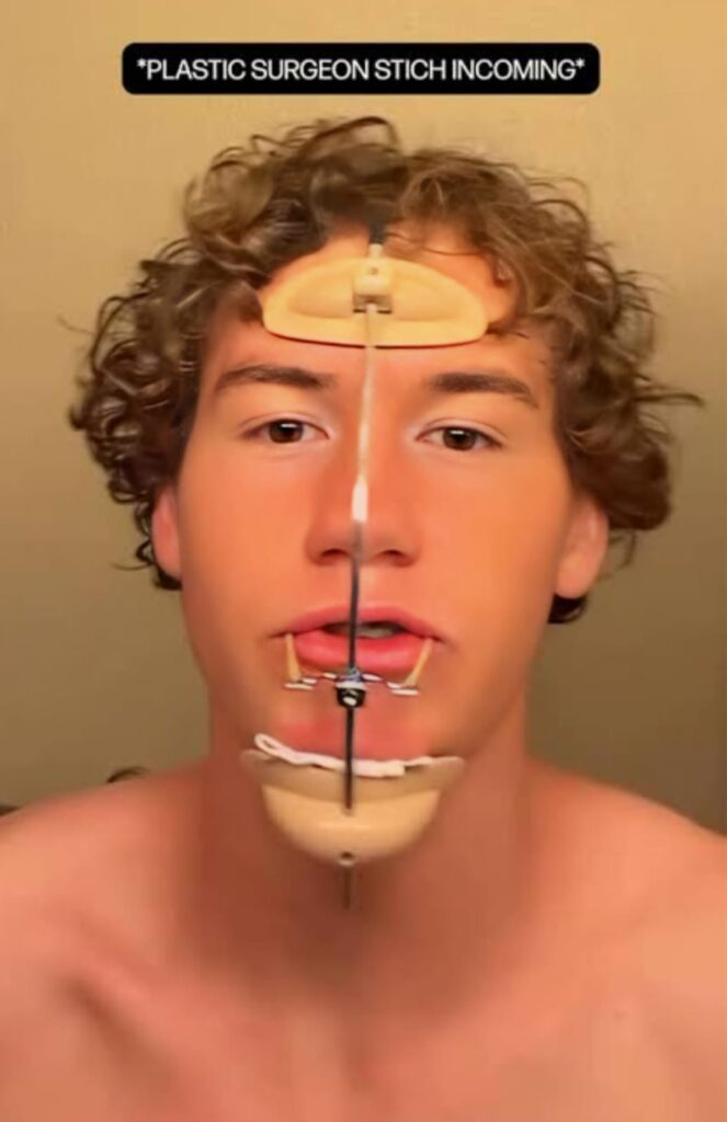 Plastic Surgery on Face