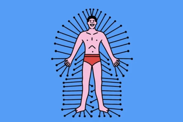 Acupuncture